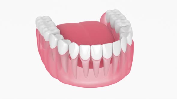 Lower jaw with gums recession process