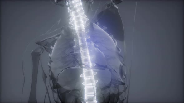 Backache in Back Bones alt