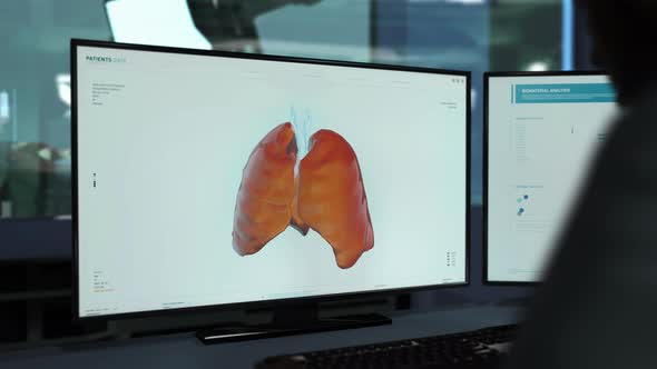 Biotechnology software has Identified Covid-19 Cells inside of Patient`s Lungs alt