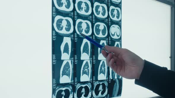 Doctor Shows Fluorography X Ray