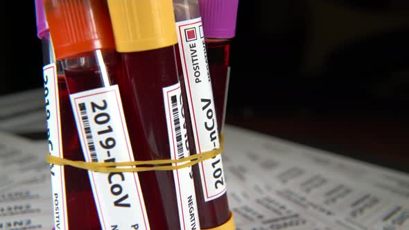 covid-19 blood test tube