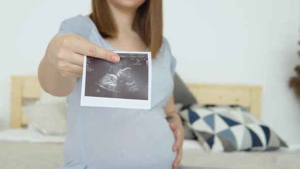 Modern Technologies for Monitoring Pregnancy