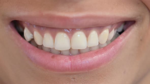 Close Up of Smiling Lips and Teeth of African Woman