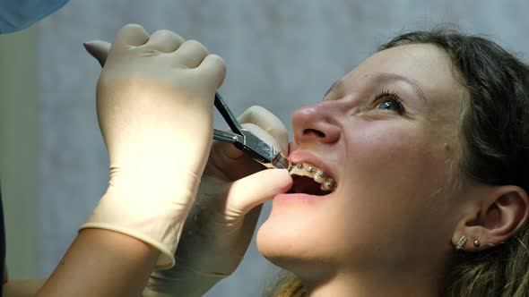 Visit the Dentist, Installation of Braces. Orthodontist Corrects the Tension of the Orthodontic Arc