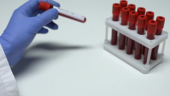 Positive Western Blot Test, Doctor Showing Blood Sample in Tube, Lab Research