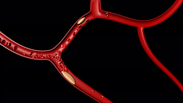 3d Clot Thrombus for Medical Health on Black