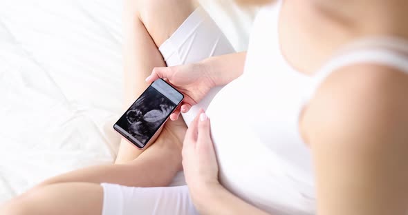 Pregnant Woman Looking at Ultrasound Picture of Fetus in Phone Closeup  Movie Slow Motion