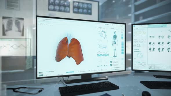 Advanced Analysis Of Pneumonia Disease Reveals Covid Virus Lung Infection