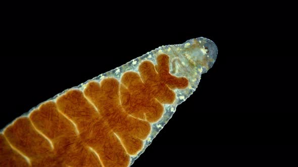 Leech of the family Glossiphoniidae under a microscope, order Rhynchobdellida