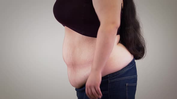 Close-up of Fat Unrecognizable Caucasian Woman Retracting Belly and Relaxing. Side View of Obese