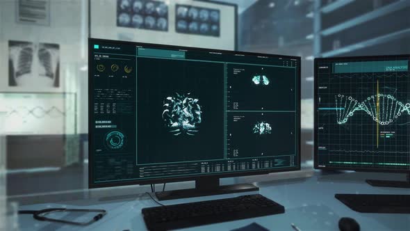 Monitor Showing Brain Analysis In Innovative Neurology Research Interface alt