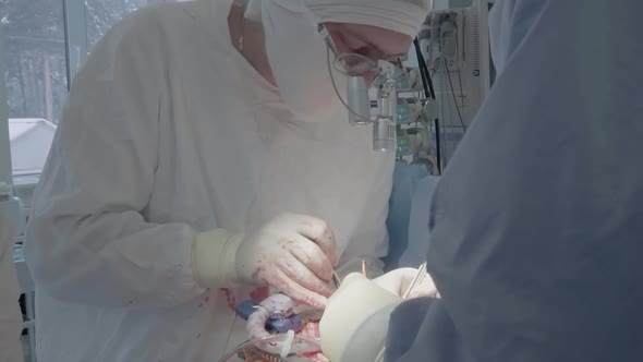 Medical Staff During a Heart Operation 2 Closeup