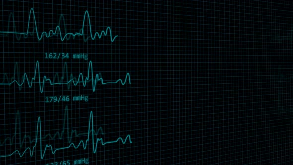 3D EKG Line Monitor