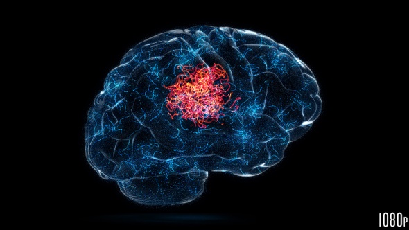 Brain Isolated Idea or Problem Headache Concept alt