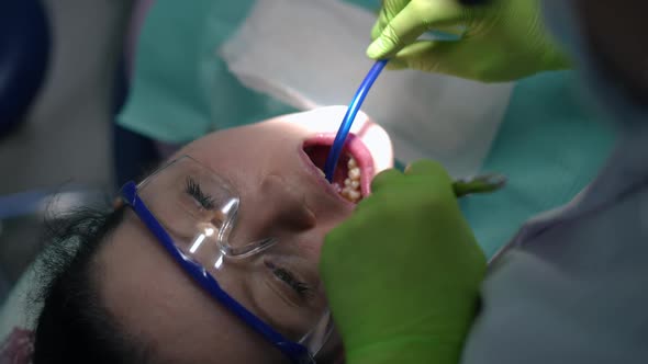 High Angle View Face of Patient in Dental Chair with Doctor Using Sucking Tube and Mirror in Slow
