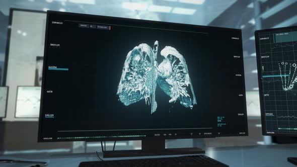 Medical Lung Structure Model Examination During Cancer Diagnosis Results alt