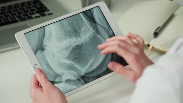 Doctor Veterinarian Examining Horse Hoof Skeleton Roentgen Closeup