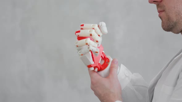 Doctor Orthopedist Conducts Tests of Robotic Prosthetic Hand Trying To Move Fingers