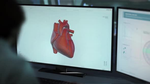 Interface of the x-ray equipment identifying blood plaques in the patients heart