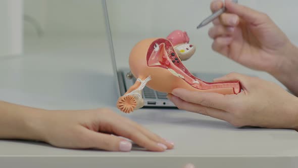 Gynecologist Doctor Consulting Patient Using Uterus Anatomy Model