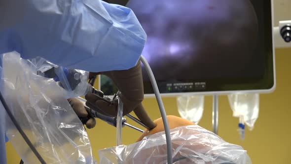 Knee Arthroscopy 8