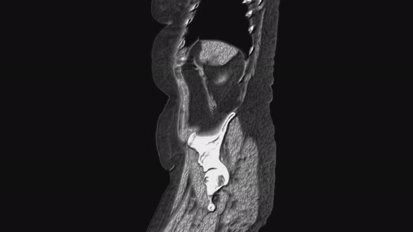 Voluminous MRI of the Abdominal Cavity, Gastrointestinal Tract, Bladder