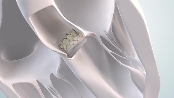 The Cardiovascular System. 3D Medical animation of the Aortic Valve Expansion