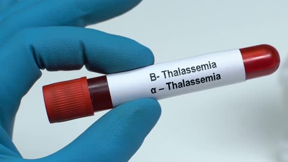 Thalassemia, Doctor Holding Blood Sample in Tube Close-Up, Health Check-Up