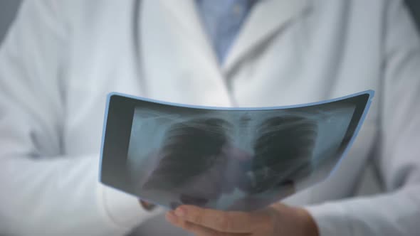 Old Female Doctor in Eyeglasses Looking at Lungs X-Ray and Shaking Head Bad News