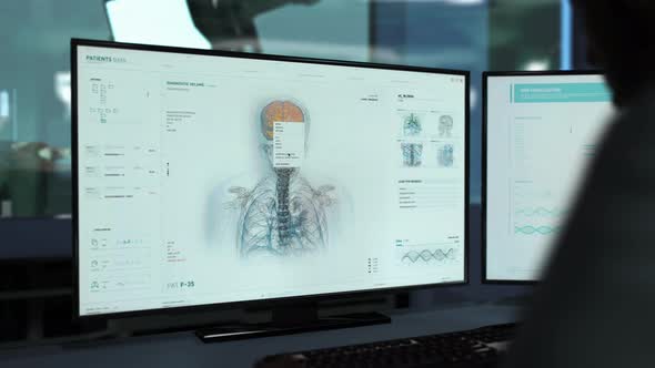 Doctor Uses Interface Of Medical Analysis Equipment To Examine Brain For Tumor alt