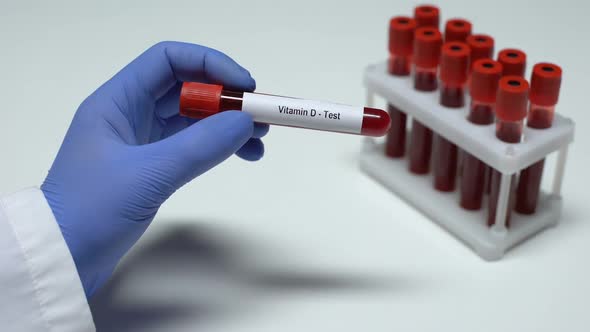 Vitamin D, Doctor Showing Blood Sample in Tube, Lab Research, Health Checkup