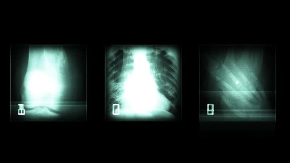 Body Parts X Ray Scan Looped.