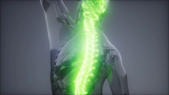 Backache in Back Bones alt