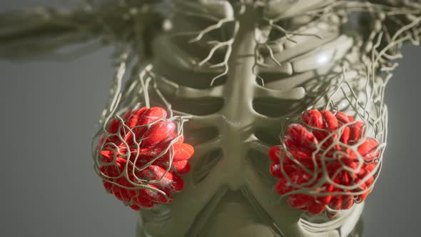 Medical Scan of Woman Breast Cancer alt