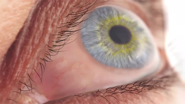 Eye pain and inflammation