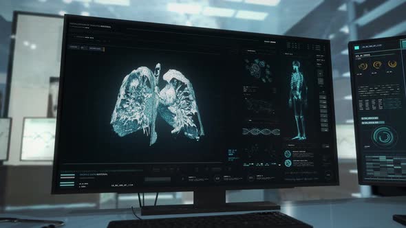 Futuristic hospital x-ray system identifies the deadly cancer in the lungs. alt