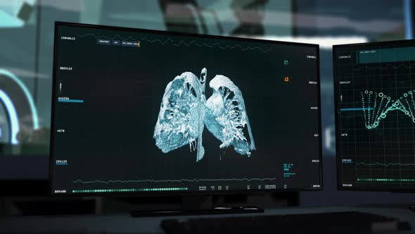 3D rendering of the human lungs. The COVID-19 Pneumonia was identified. UI.