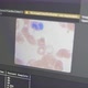 Blood Cells Microscopy Training Deep Learning Neural Network Model - VideoHive Item for Sale