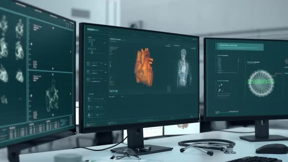 Analysis Of Hearts Health In Medical Care Interface Detects Cardiac Ischemia alt