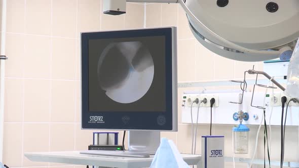 Doctor Video Footage - An On Going Operation Seen On A Monitor