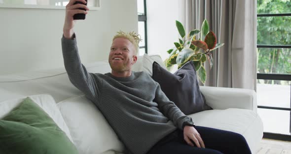 Happy albino african american man with dreadlocks using smartphone