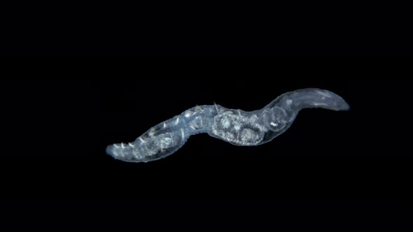 worm Nais sp. under a microscope, Family Naididae, a class of Oligochaeta