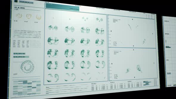 Futuristic Medical Treatment Interface Of Pandemic Covid-19 Respiratory Virus alt