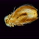 the Larva of the Polychaeta Worm Under the Microscope, at the Nektohet Stage, of the Spionidae - VideoHive Item for Sale