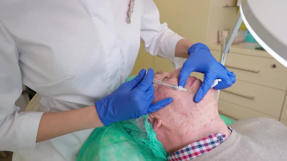 Midle Aged Man Getting Biorevitalization Lifting Procedure in Cosmetology Clinic