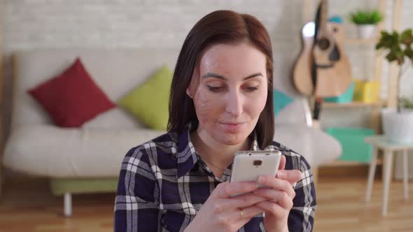 Close Up Young Woman with a Burn Scar on Her Face Using a Smartphone