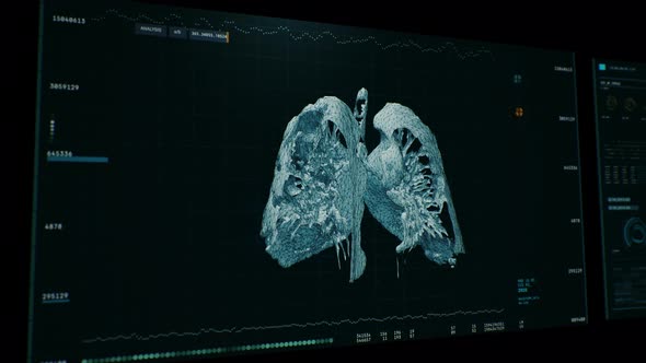 Lung scan has found the Covid-19 Pneumonia cells at pandemic research laboratory