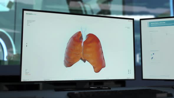 Biomaterial analysis software has found the Coronavirus Cells in the patient alt