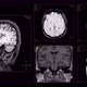 Head MRI scan from different angles - VideoHive Item for Sale