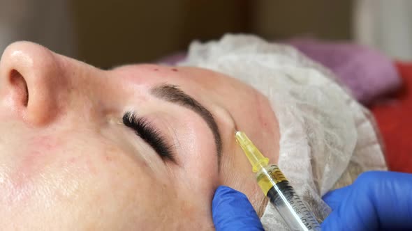 Close-up of the beauticians hand in blue rubber gloves injecting a woman in the face with a syringe